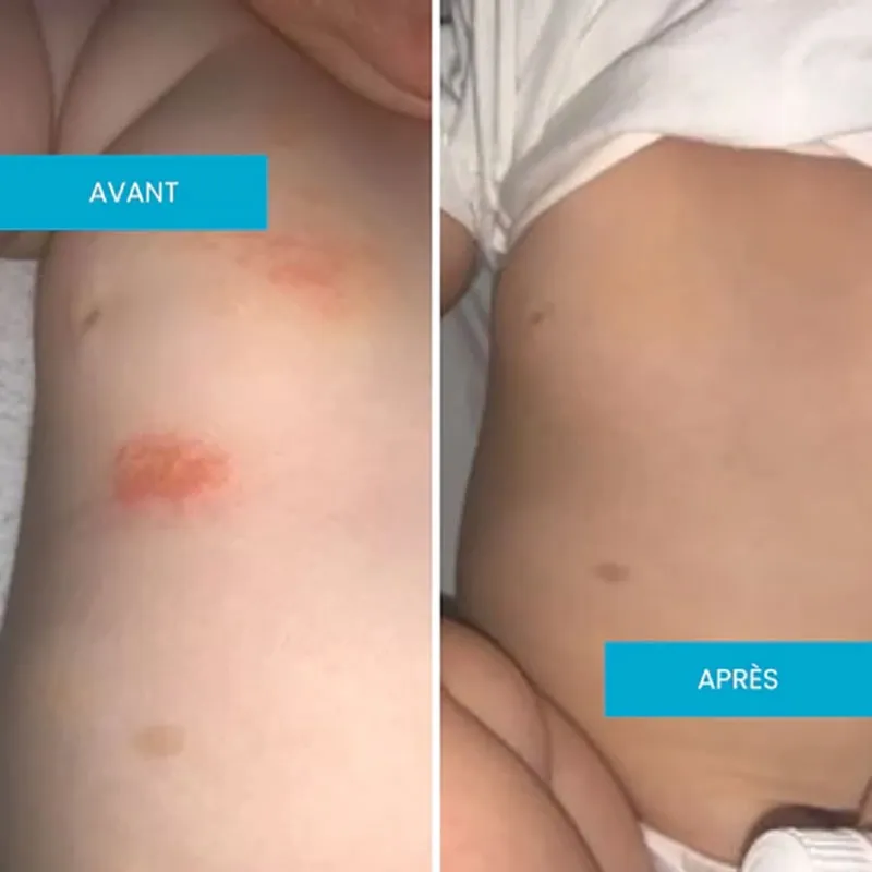 Produits de Soin Maman et Bébé-7
